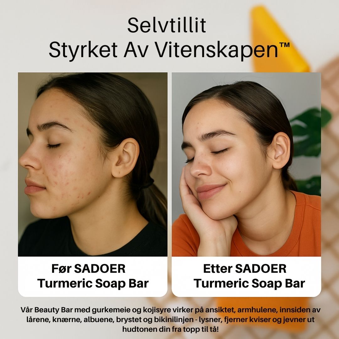 SADOER - Premium Turmeric Soap Bar